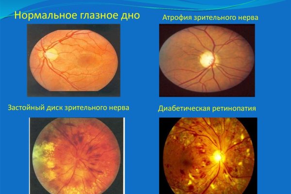 Найти ссылку кракен
